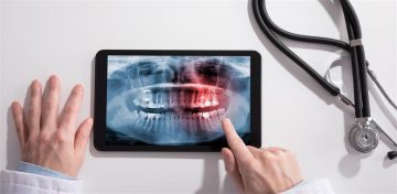 Os avanços da Radiologia Digital para a Odontologia